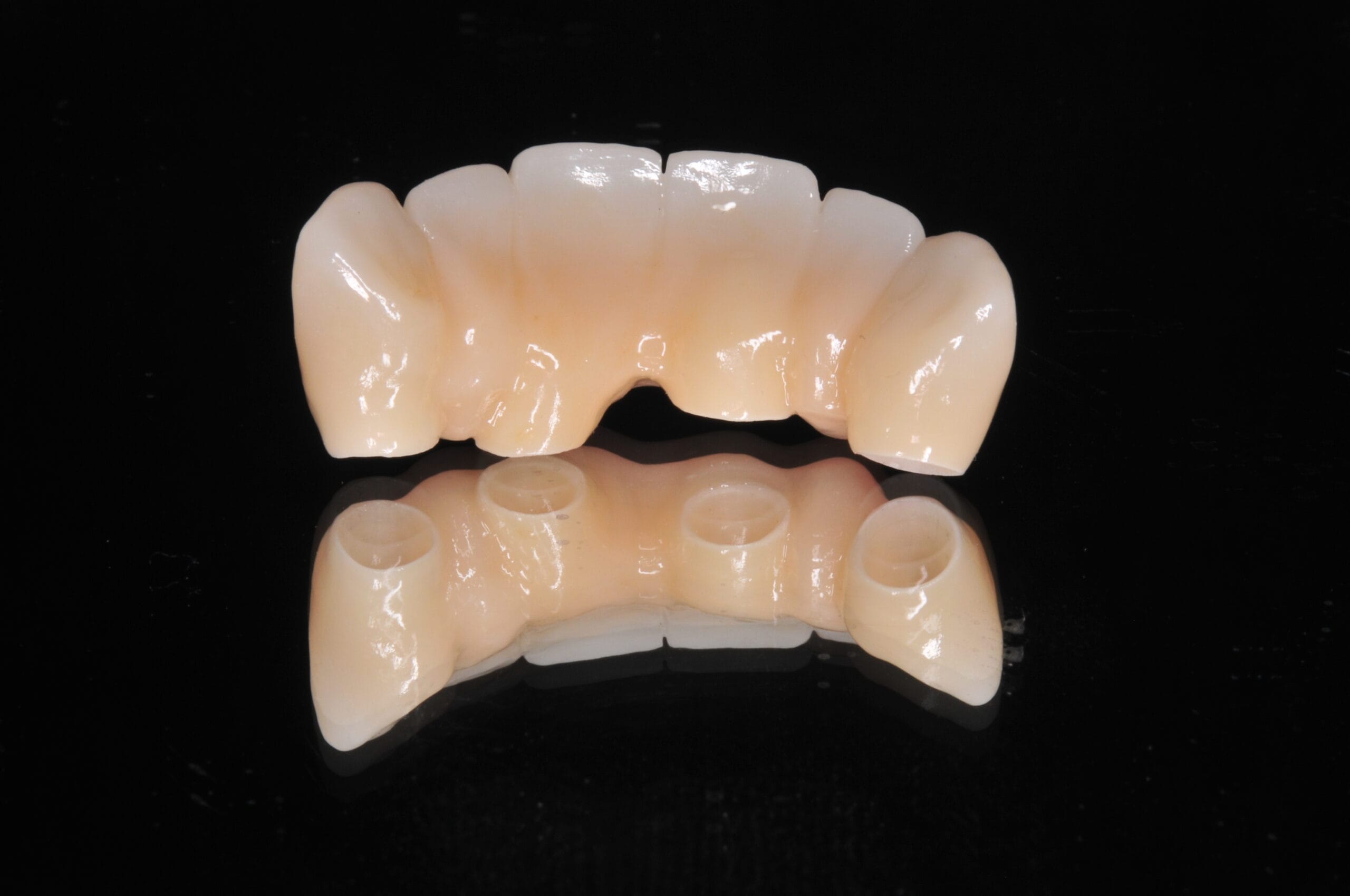 Vista inferiore di un ponte dentale in zirconia prodotto dal Laboratorio Odontotecnico Massimo Sargentini, con fori di connessione implantare perfettamente allineati.