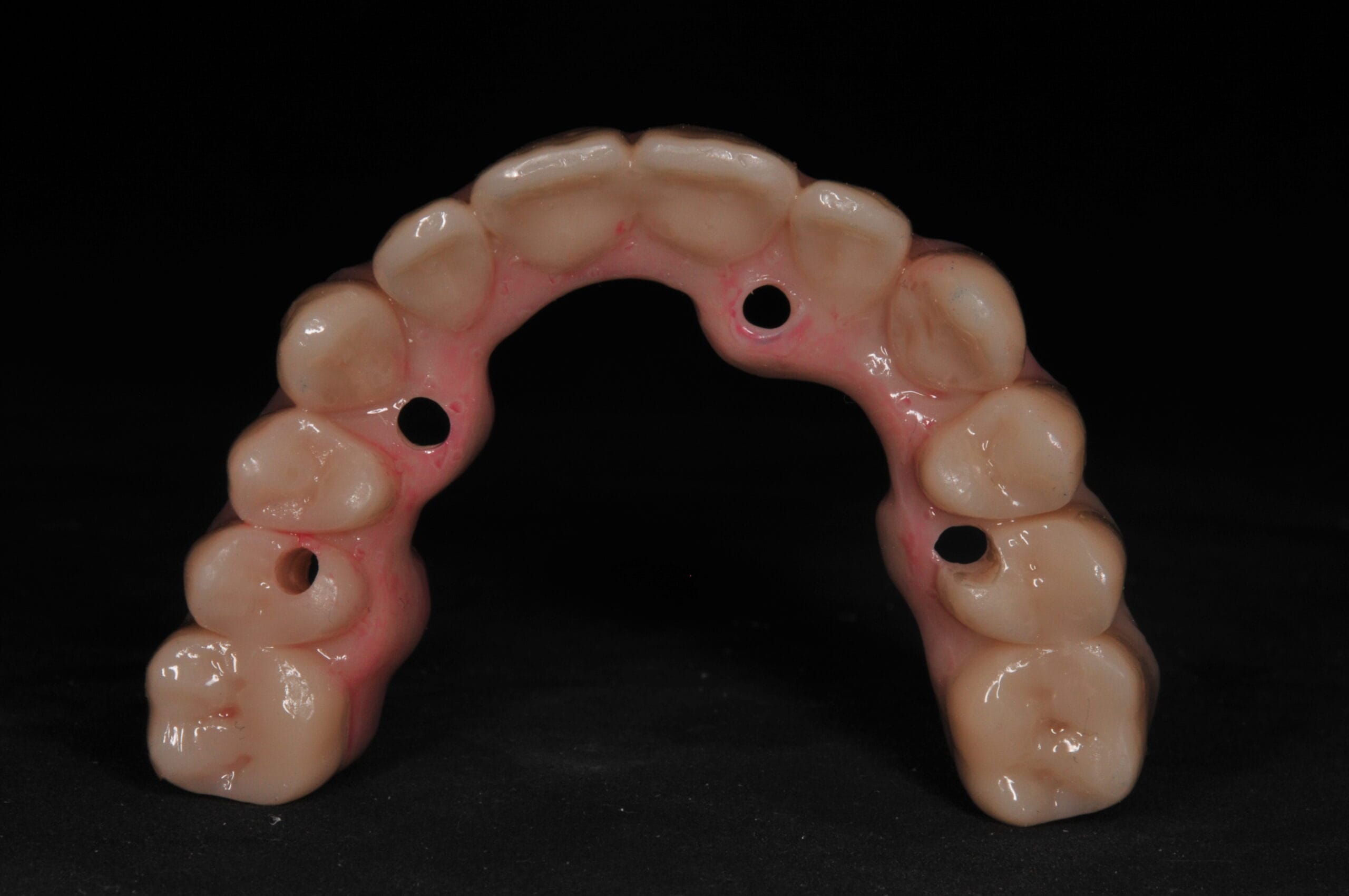 Vista inferiore della protesi di Toronto su impianti, lavorazione del Laboratorio Odontotecnico Massimo Sargentini a Sesto San Giovanni.