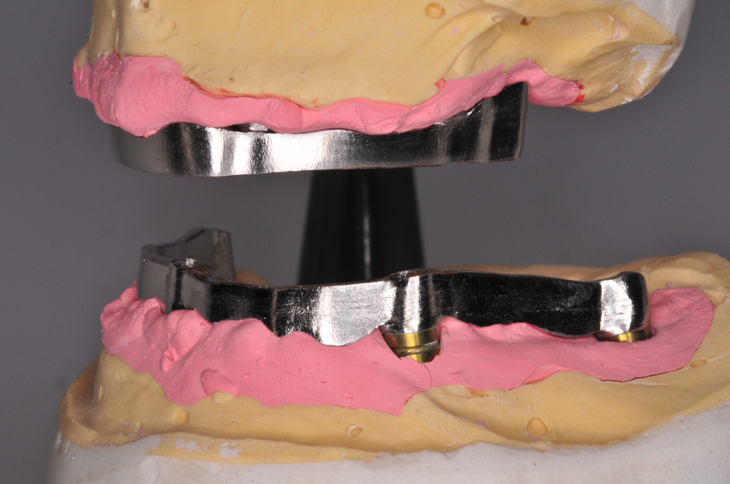 Struttura interna in titanio per protesi di Toronto, realizzata nel Laboratorio Odontotecnico Massimo Sargentini per garantire stabilità e perfetto adattamento sugli impianti.